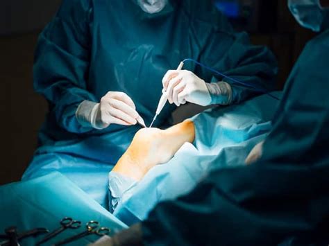 Joint Replacement Surgery .